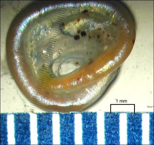 Figure 14. Larval Contracaecum sp. from a freshwater fish, showing typical coiled position.