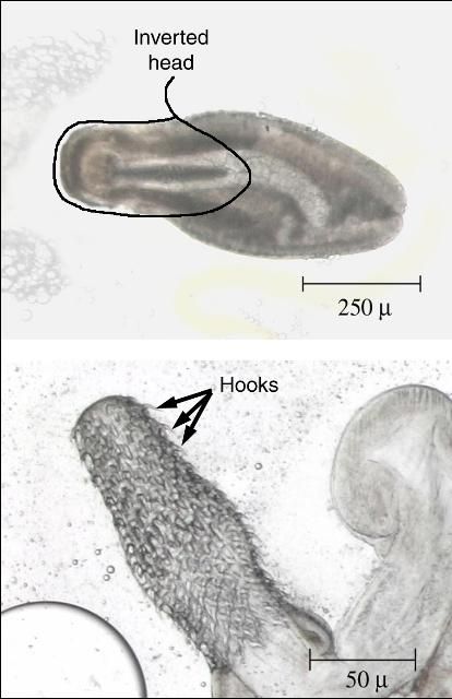 Figure 5. Photomicrograph showing acanthocephalan with head inverted (top) and head everted showing typical thorny head with hooks (bottom).