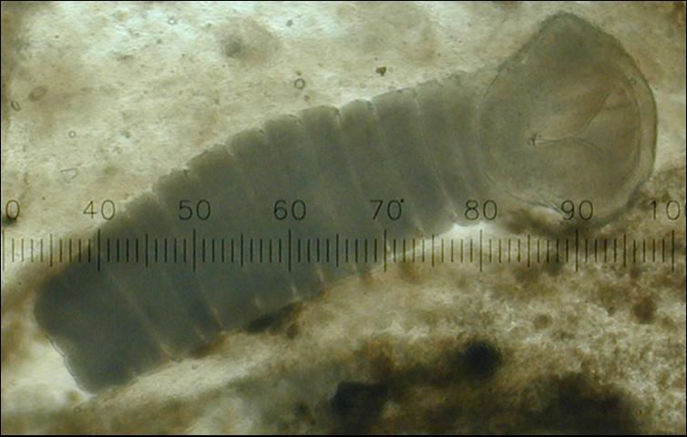 Figure 2. Photomicrograph of a tapeworm showing typical segmentation.