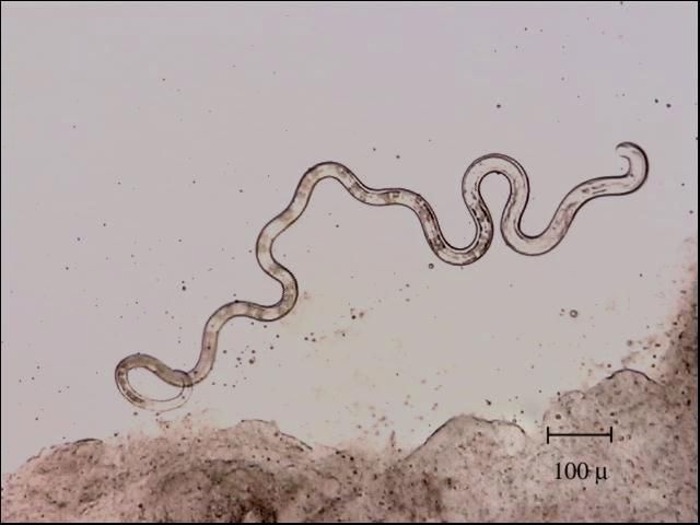 Figure 1. Photomicrograph of a Capillaria nematode showing typical nematode shape.