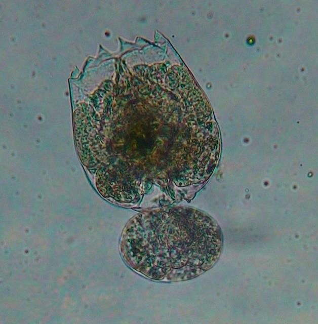 Figure 1. Picture of adult rotifer with egg attached.