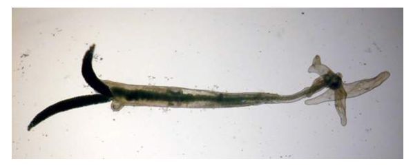 Figure 3. Adult female, removed from fish. Note 