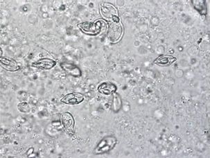 Figure 4b. Wet mount prep from a fish gill, myxozoa; close-up of myxozoa found within gill.