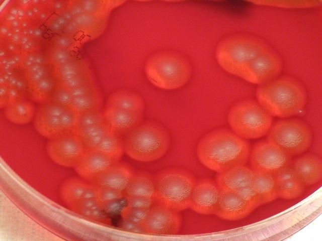 Close-up picture of Bacillus cereus colony in a petri dish. The dish has a solid red, background substance with round bubble-like contents of various sizes which stick together and have bright red-pink edges and a soft red center.