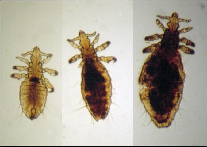 Figure 8. Long-nosed cattle louse (sucking louse).