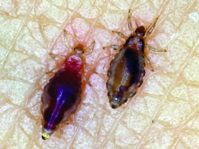 Figure 1. Adult body lice. Right unfed, left blood-fed.