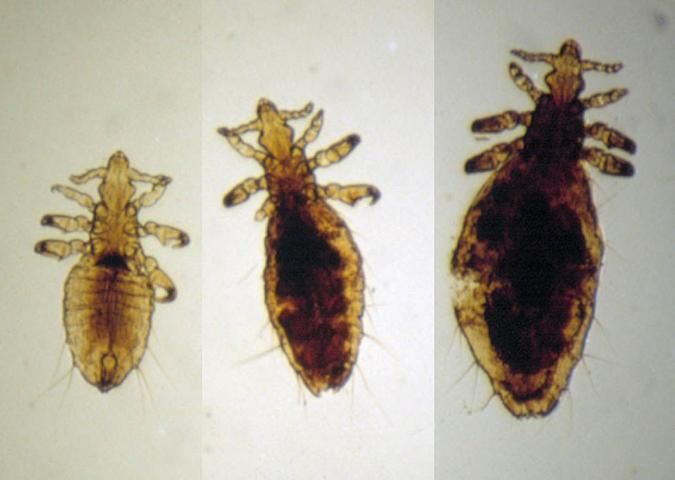 Figure 9. Long-nosed cattle louse (sucking louse).