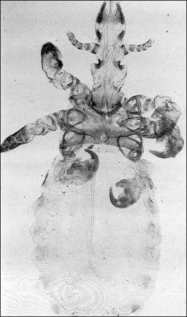 Figure 14. Horse sucking louse.