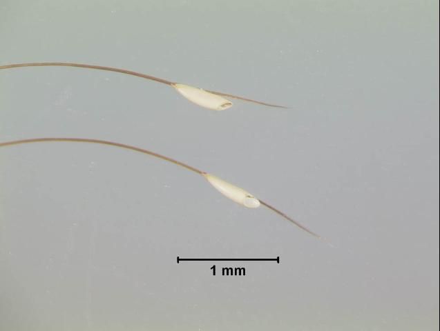 Figure 4. Close-up of horse bot fly eggs.