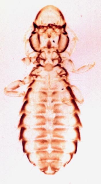 Figure 3. Chicken head louse.