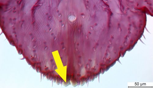 Figure 6. An enlarged section of Figure 5 the yellow arrow points to the the median lobes of the adult female citrus snow scale Unaspis citri Comstock, which is one characteristic used for identification of this species.