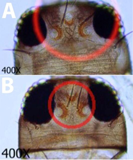 Figure 6. A) Interocular setae arising far apart (Characteristic of F. bispinosa and F. occidentalis). B) Interocular setae arising close together (Characteristic of F. schultzei).