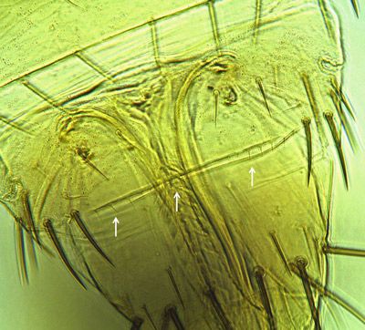 Figure 5. Abdominal segment VII of Frankliniella bispinosa Morgan with incomplete comb (arrowed); Frankliniella occidentalis has a complete comb.