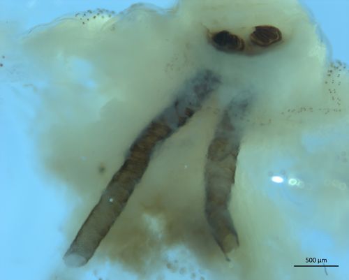 A magnified photo of an amorphous, cream-colored mass with two dark-colored, translucent tubes prominent in the center.