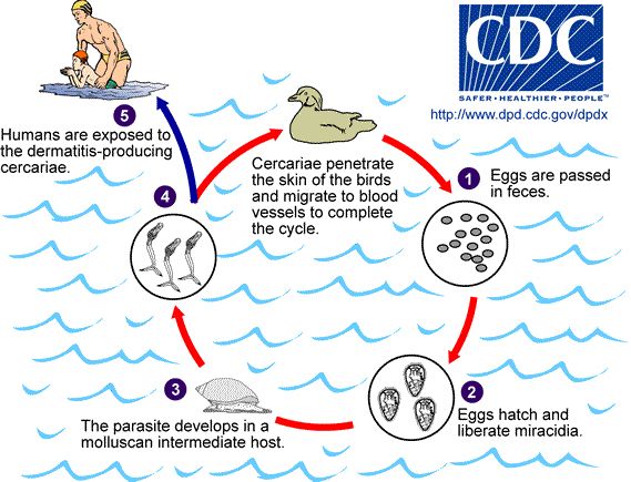Figure 1. Life cycle of the parasites that cause swimmer's itch.