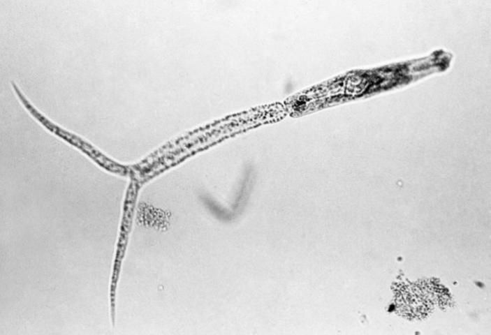 Figure 2. A schistosomal cercaria (150? magnification).