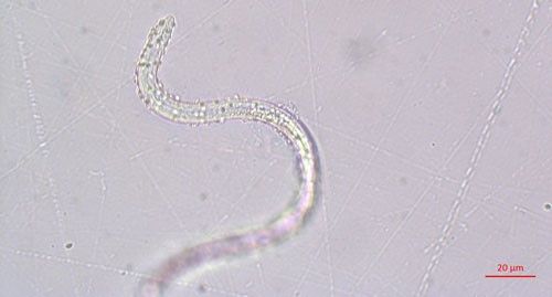 Figure 2. Meloidogyne arenaria nematode with Pasteuria penetrans endospores adhering to its cuticle.