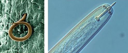 Figure 2. Left: a juvenile root-knot nematode (Meloidogyne incognita) penetrates a tomato root (photo by W. Wergin and R. Sayre, USDA-ARS); right: head of a plant-parasitic nematode with protruding stylet.