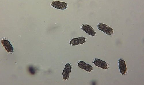 Figure 3. Young eggs of the grass root-knot nematode, Meloidogyne graminis Whitehead Cells are starting to divide.