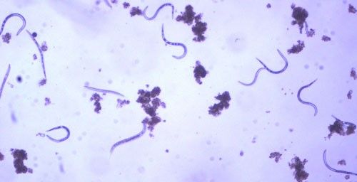 Figure 5. Second-stage juveniles (J2) of the grass root-knot nematode, Meloidogyne graminis Whitehead, extracted from soil, along with a few bacterial-feeding nematodes. J2 are worm-shaped and mobile; this is the infective stage.