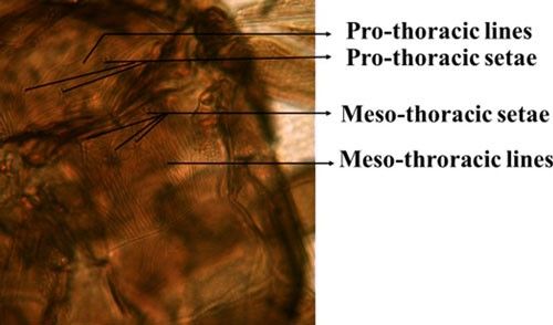 Figure 6. Pro and meso thoracic segments of an adult composite thrips, Microcephalothrips abdominalis Crawford, showing the lines and setae.