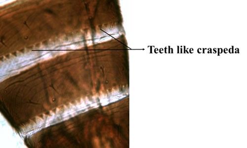 Figure 9. Tergites VI and VII of an adult Microcephalothrips abdominalis Crawford, showing teeth like craspeda on the posterior margin.