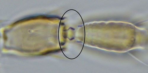Figure 3. Setae arising from antennal segment II of Frankliniella tritici (Fitch) are simple. The antennal segment three pedicel is swollen and mushroom-like (circled).