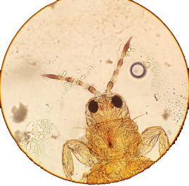 Figure 6. Magnified view of thrips collected from olive in Florida.