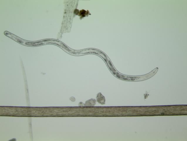 Figure 2. Size of a lance nematode (one of the largest plant-parasitic nematodes) compared to a human hair.
