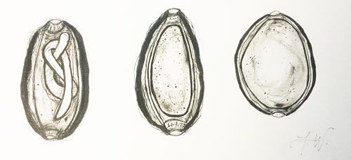 Figure 3. Three egg stages of a Huffmanela nematode. The far right egg is recently laid, and the eggs develop from right to left. The middle egg is unlarvated, but has a fully developed shell. The left egg has a fully larvated nematode ready to emerge.