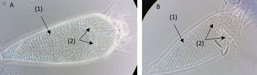 Figure 2. Morphological differences between the citrus rust mite, Phyllocoptruta oleivora (Ashmead) (A), and the pink citrus rust mite, Aculops pelekassi (Keifer) (B), observed with a phase-contrast microscope.