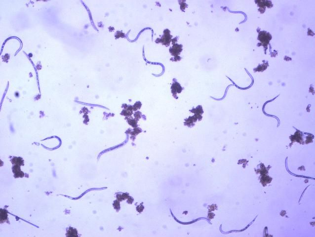 Figure 5. Second-stage juvenile (J2) root-knot nematodes extracted from soil, along with a few bacteria-feeding nematodes. Second-stage juveniles are worm-shaped and mobile; this is the infective stage.