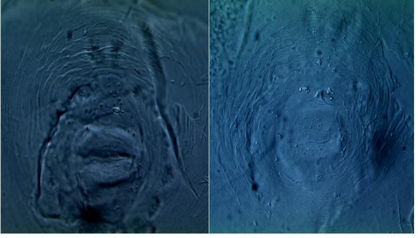 Figure 1. Photomicrographs of perineal patterns of two individual females of Meloidogyne haplanaria from Florida. Scale bar=10 µm.