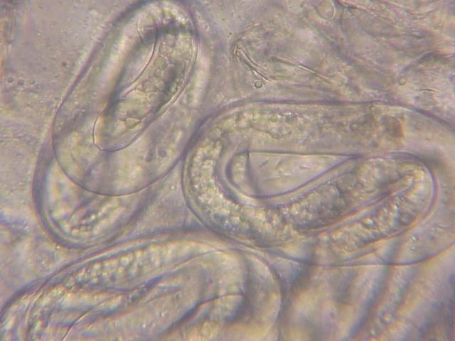 Figure 4. Mature eggs of root-knot nematodes. The second-stage juveniles (J2) can be seen coiled up inside indicating the egg is getting ready to hatch.