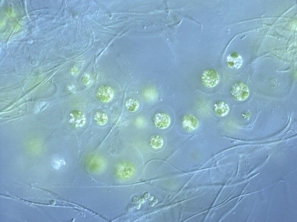 Figure 5. Trebouxia sp., an alga often found in lichen associations.