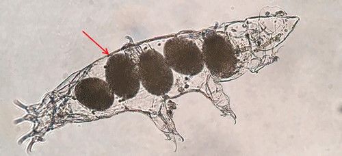 Figure 3. Image of eggs inside a tardigrade exoskeleton.