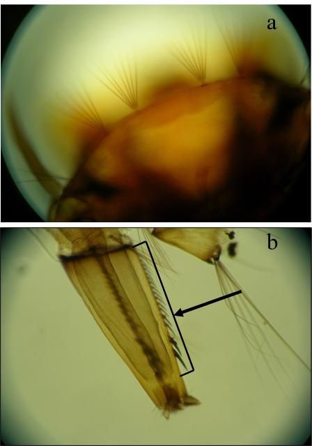 Figure 5. (a) Branched setae along front margin of larval Aedes japonicus (Theobald) head arranged in straight row. (b) Pecten along almost entire length of the larval Aedes japonicus siphon, which is made up of teeth that are larger and further apart closer to the siphon's tip.