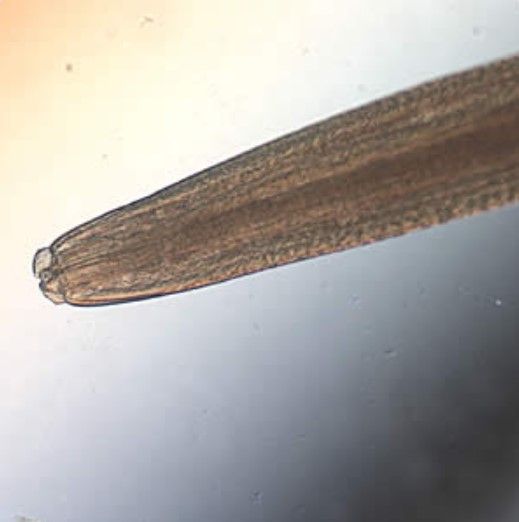The piercing stylet of Pseudoterranova decipiens showing prominent lips.  