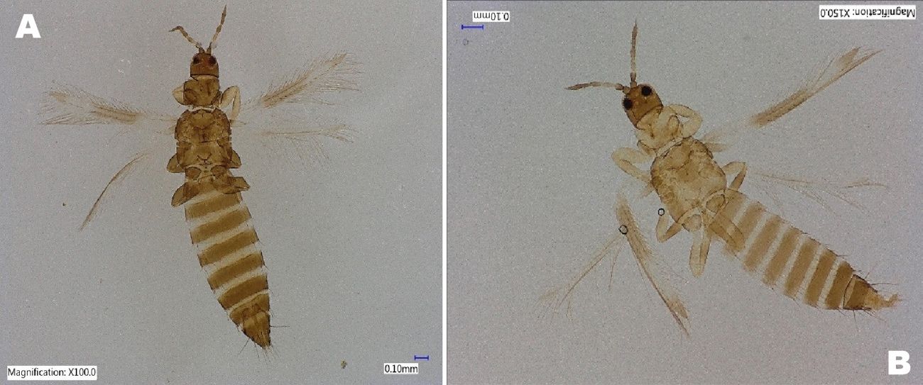 Adult female (A) and male (B) bean flower thrips, Meagalurothris usitatus Bagnall (dorsal view).