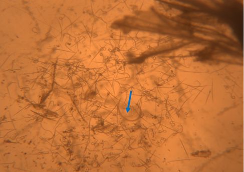 Contents from ruptured Anguina pacificae gall including juveniles and adults. The blue arrow points to an adult. All the smaller nematodes present are juveniles. 