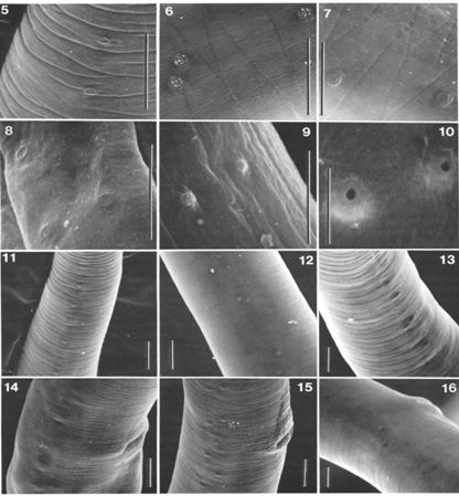 The characteristic ridges and creases seen in the cuticle of Trichinella spiralis, under electron microscopy. 