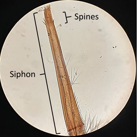 Shown here a crown of prominent spines before the siphon apex of Culex coronator. 