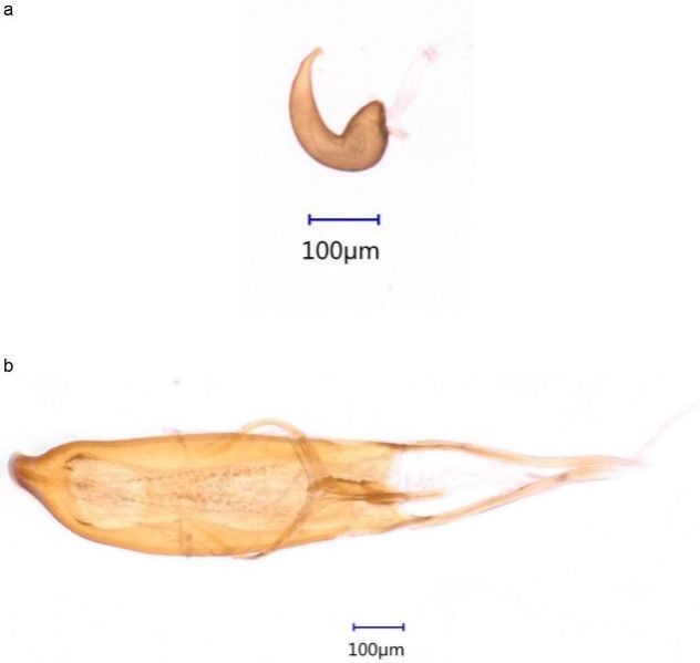 Genitalia a) de la hembra y b) del macho de Anthonomus testaceosquamosus. 