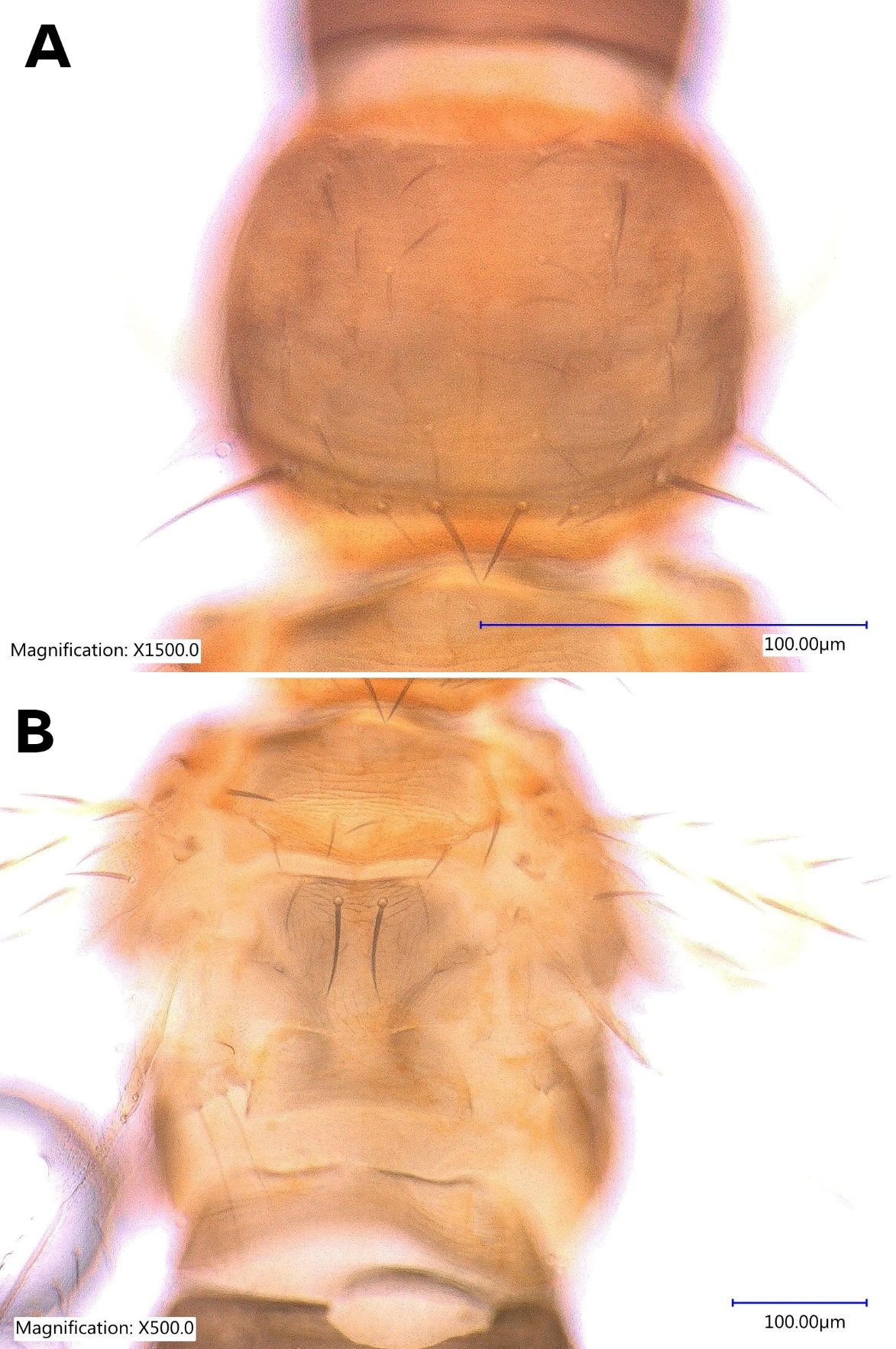 Prothorax (A) and meso-metathorax (B) of adult female Taiwanese thrips, Thrips parvispinus (Karny) (dorsal view) at higher magnification showing thoracic setae. 