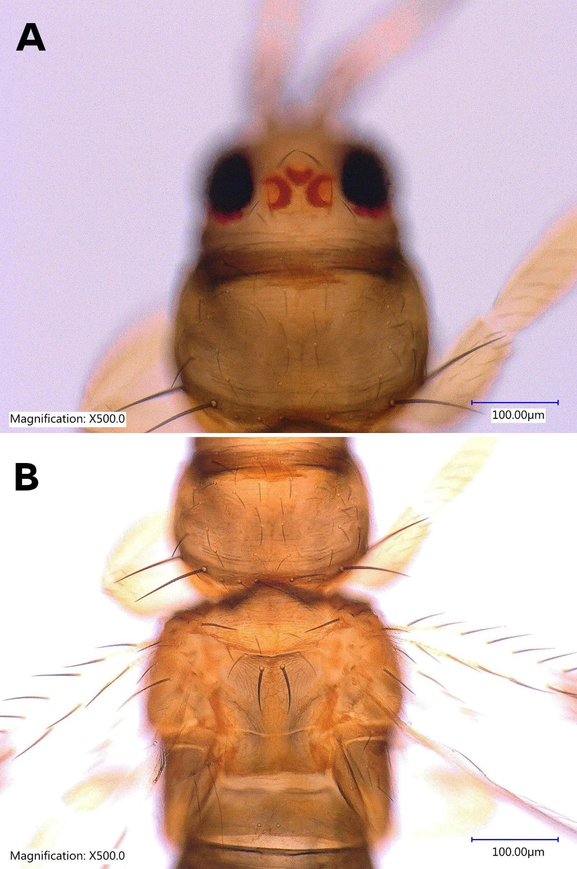 Head and prothorax of adult female Taiwanese thrips, Thrips parvispinus (Karny) (dorsal view) showing ocellus and ocellar setae (A). Thoracic segments of adult female Taiwanese thrips, Thrips parvispinus (Karny) (dorsal view) (B). 