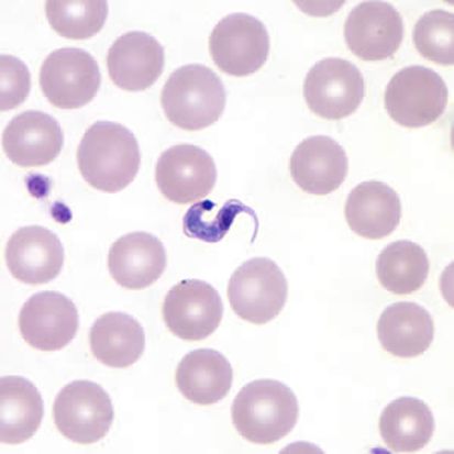 Trypanosoma cruzi, a protozoan parasite, stained purple among red blood cells.