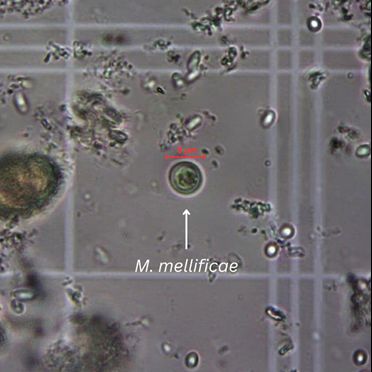 A compound slide prepared via the method described under “Conducting Visual Confirmation.” The cyst stage of Malpighamoeba mellificae is identified with a white arrow. At 400x magnification, the cysts are approximately 8-10 µm in diameter and round, with a distinct cell wall. Note the background of Nosema sp. spores (bright ovals and spheres).