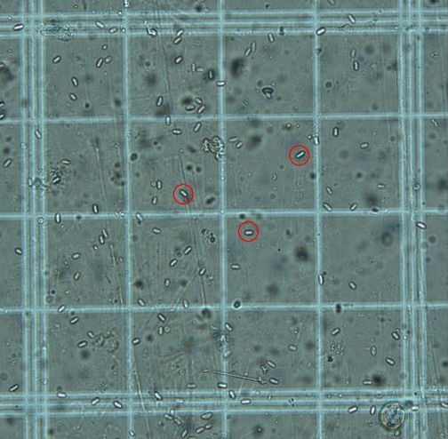 A hemocytometer under 400x magnification with three Nosema sp. spores circled in red.