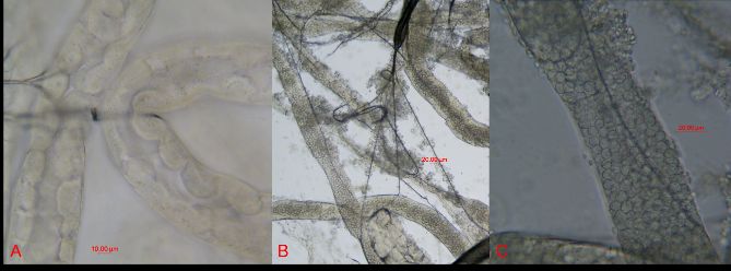 Left, healthy, uninfected Malpighian tubules of a honey bee. Center, multiple Malpighian tubules filled with Malpighamoeba mellificae cysts. Right, a single magnified Malpighian tubule filled with Malpighamoeba mellificae cysts. 