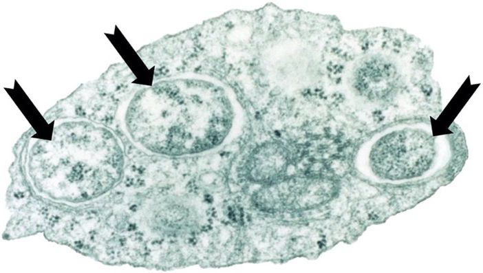 Image of Wolbachia in an insect cell. Arrows indicate the position of three Wolbachia living inside the cell of a moth, captured by transmission electron microscopy. 